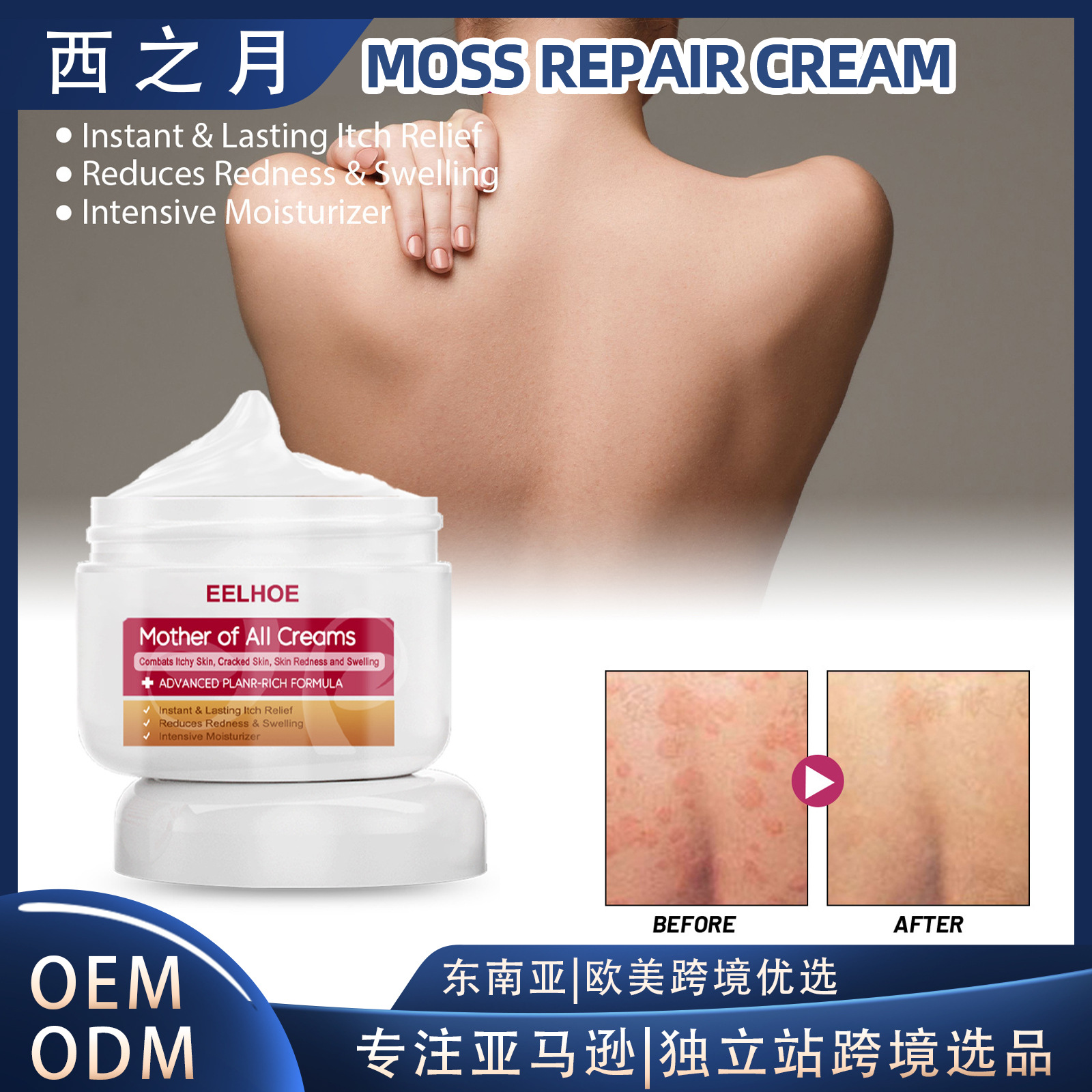 Eelhoe Skin Moss Hands and Feet Moisturizing Cream Repair Relieve Itching Relieve Itching Moisturizing Skin Hydrating Moisturizing