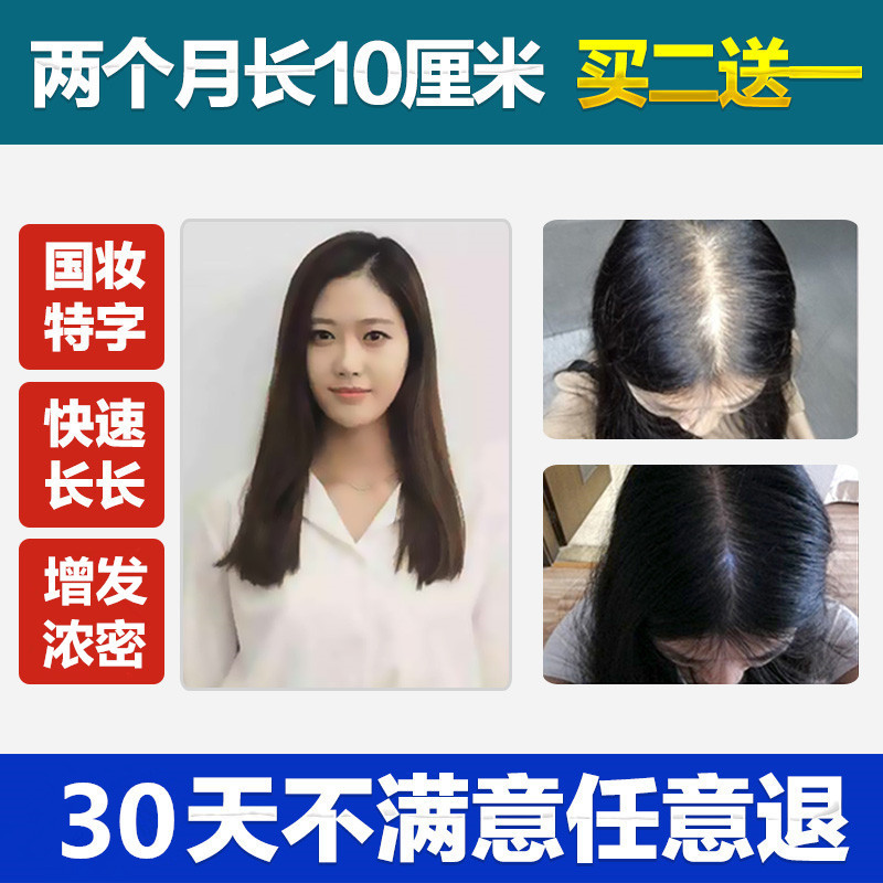 包邮头发增长液快速短发变长发剂加快生长浓密增发密发防脱生发液