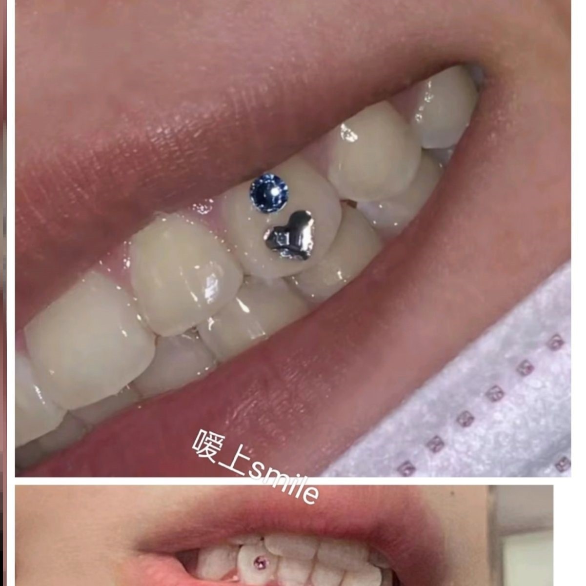 牙钻自己粘牙钻胶欧美镶钻水晶钻diy专用套装施华洛满钻牙饰高档