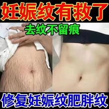 妊娠纹修护霜产后祛孕纹预防肥胖纹生长纹紧致收腹去妊辰纹修护霜