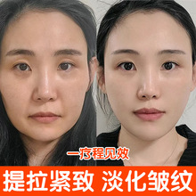 胶原蛋白填充霜重组霜去抬头纹法令纹填充凹陷紧致逆龄高保湿面霜