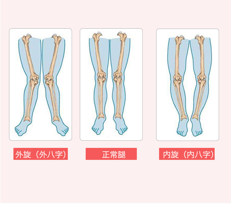 儿童o型腿矫正带内八外八字脚型纠正小孩腿部矫形带内外旋矫正器