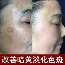 熊果苷美颜亮白vc精华改善黑色素色斑黄褐斑提亮肤色淡化暗沉原液