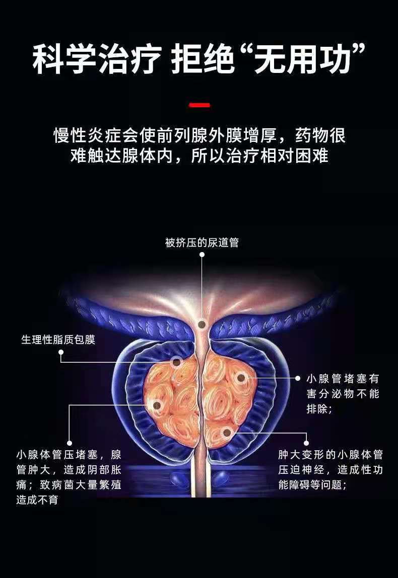 前列腺仪家用按摩器强男用慢性增生肥大男性红光理疗