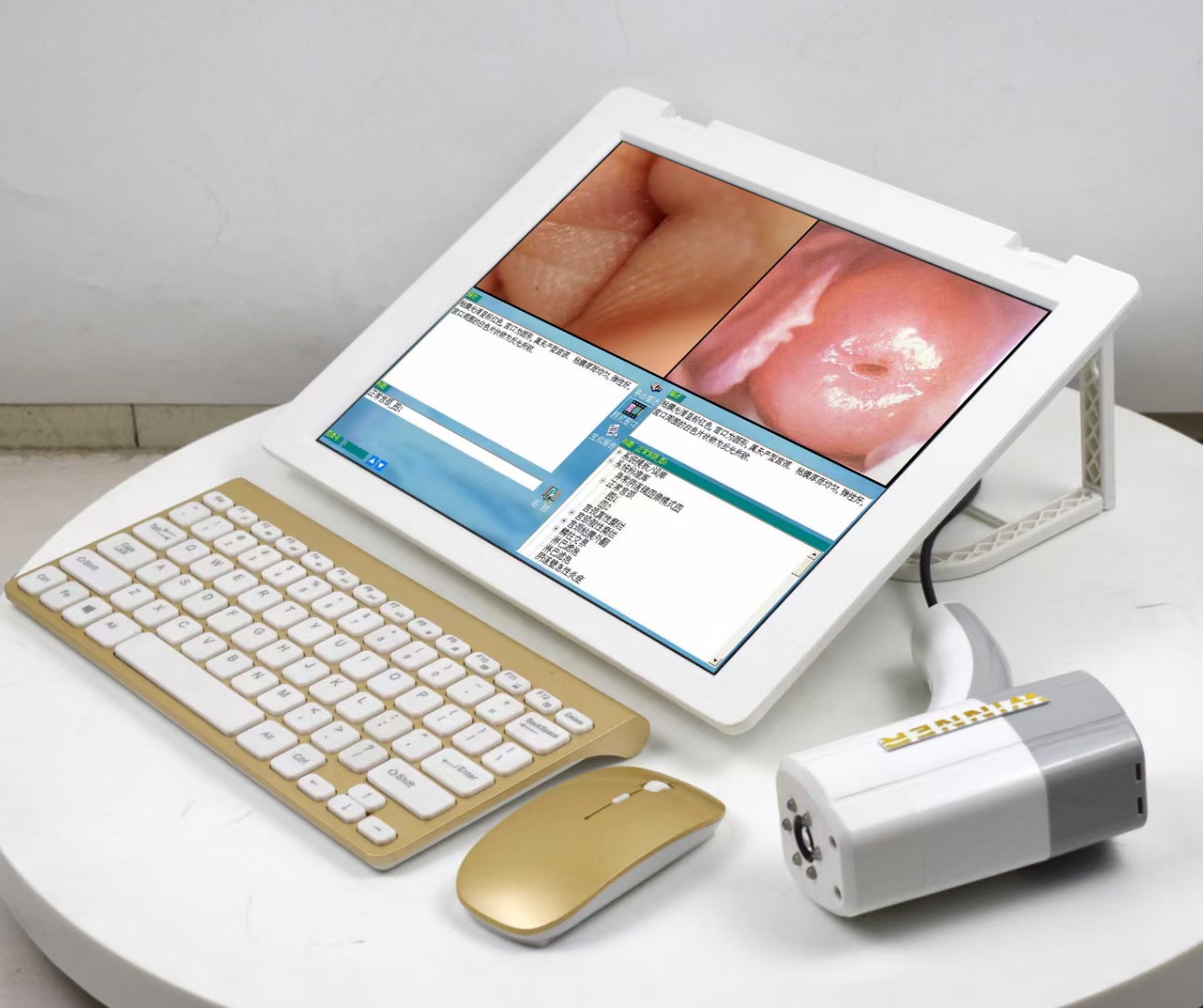 女人透视镜高清内窥镜电子私密妇科检测仪便携式一体机高清检测