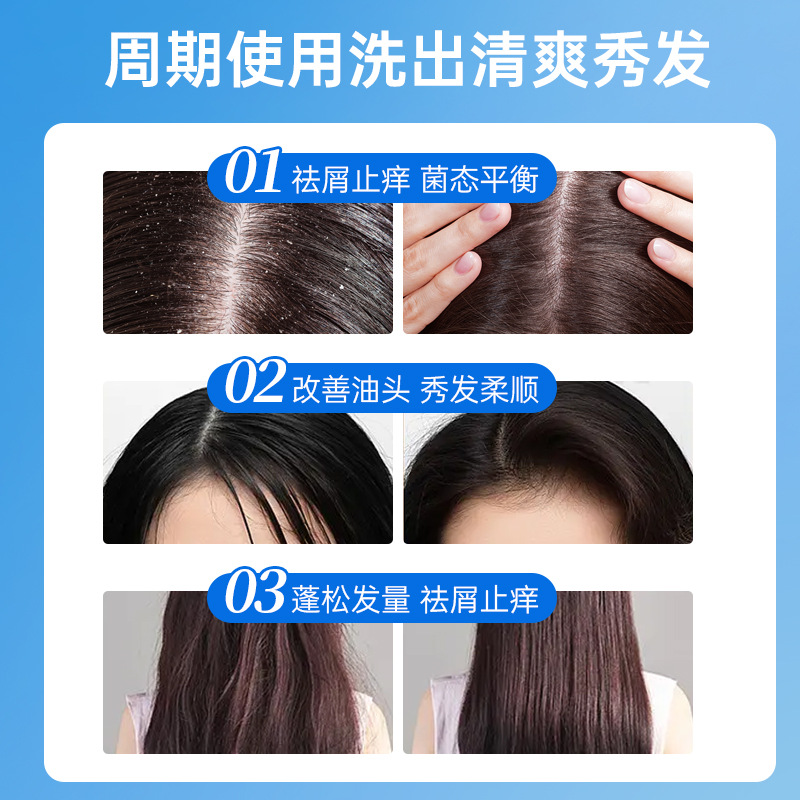 Dinkiss Selenium Disulfide Anti-Dandruff Shampoo Anti-Itching Oil Control Anti-Mite Refreshing Fluffy Softener Shampoo