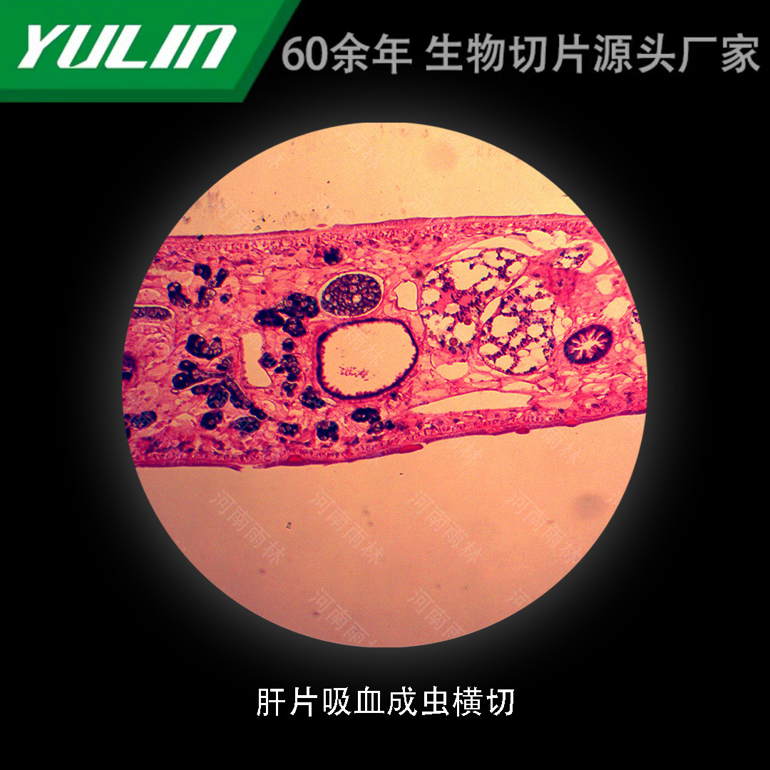 人大肠绒毛状腺瘤切片高校医学院校用组织病理石蜡玻片标本显微镜
