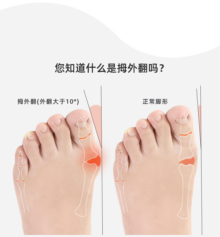 拇指外翻矫正器 脚趾外翻 大脚骨矫正带分趾器日用 脚趾分开保护