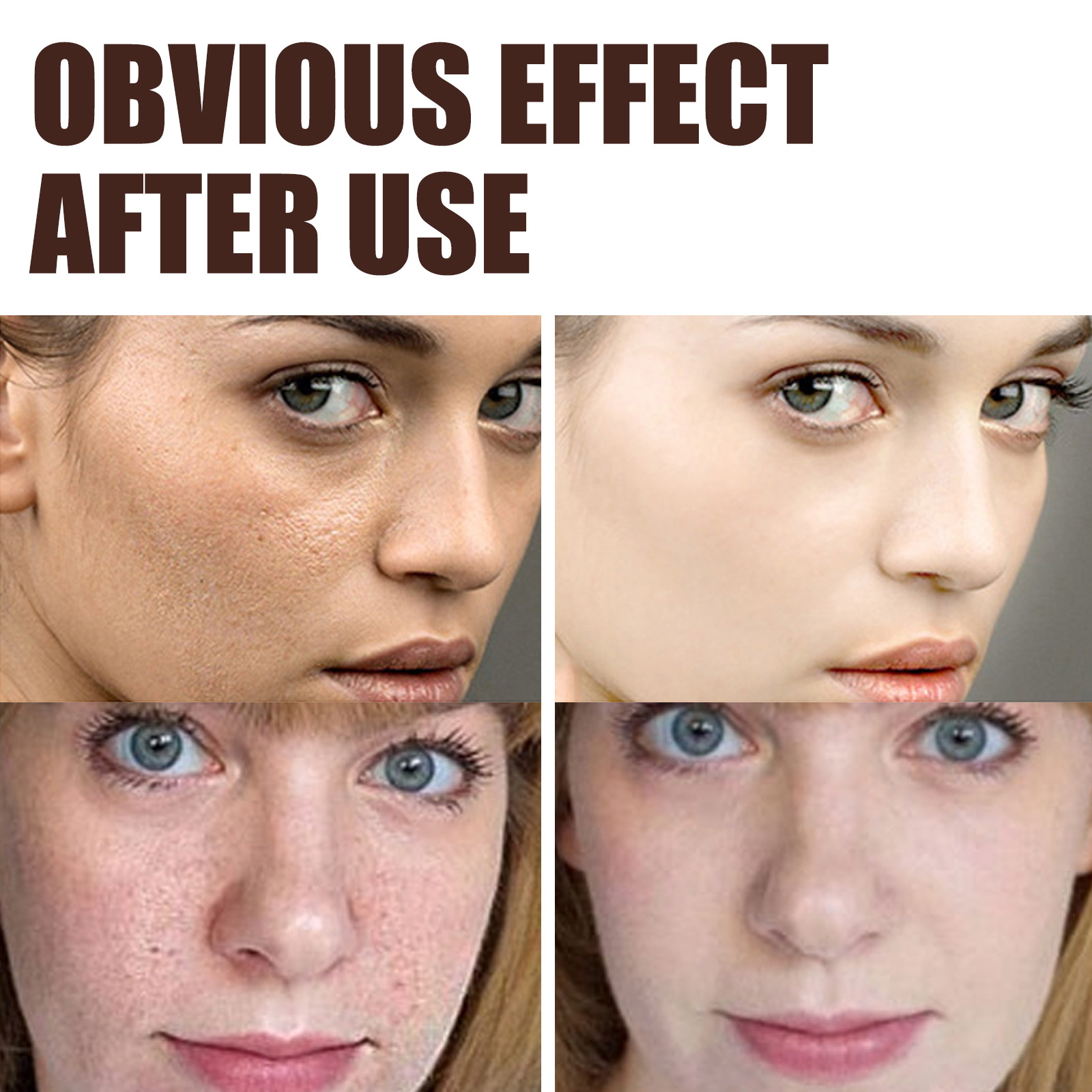 Eelhoe Retinol Cream Anti-Aging Wrinkles Firming Lifting Brightening Skin Color Moisturizing Facial Skin Skin Skin Care