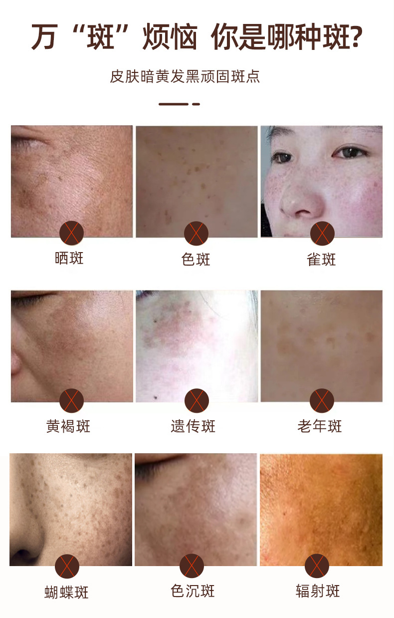 祛斑霜美白淡化色斑去黑色素淡斑去斑祛黄褐斑雀妊身斑化妆品批发