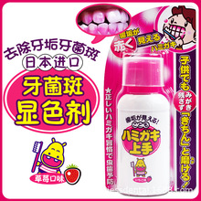 牙菌斑显示剂日本儿童口腔祛除显色去牙垢神器指示剂染色液体牙膏