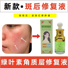 叶绿素角质层增厚液祛斑后脸红脸痒修复角质层敏感肌表皮修复液