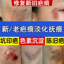 祛淡化疤膏修复去剖腹产增生疤手术疤烧伤疤痕美容院妊娠纹修复霜