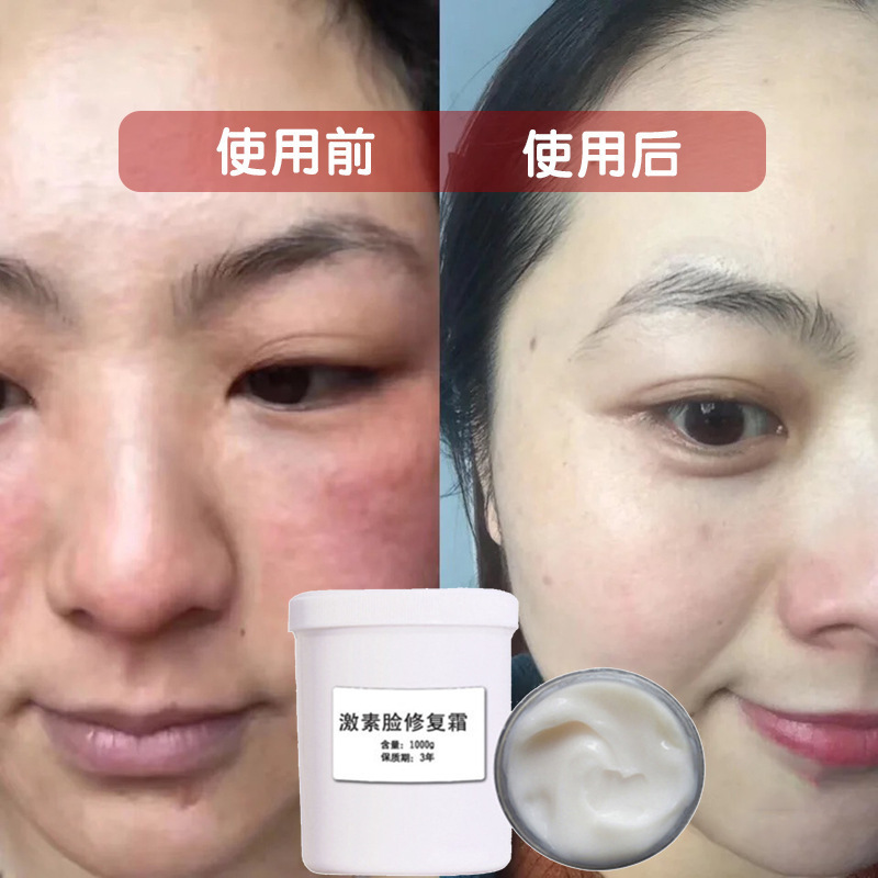 积雪草修复霜退红去红血丝增厚角质层修复敏感肌激素脸面霜美容院
