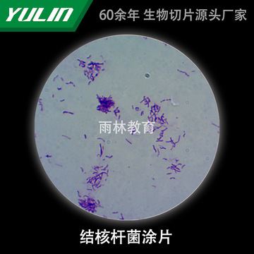 结核杆菌涂片生物切片实验室研究显微镜玻片高校教学微生物科研