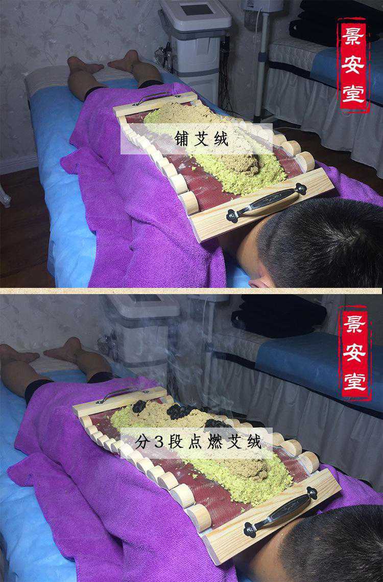 隔姜灸督脉艾灸盒背部龙骨家用铺火龙灸脊椎长蛇具器具好用可批发