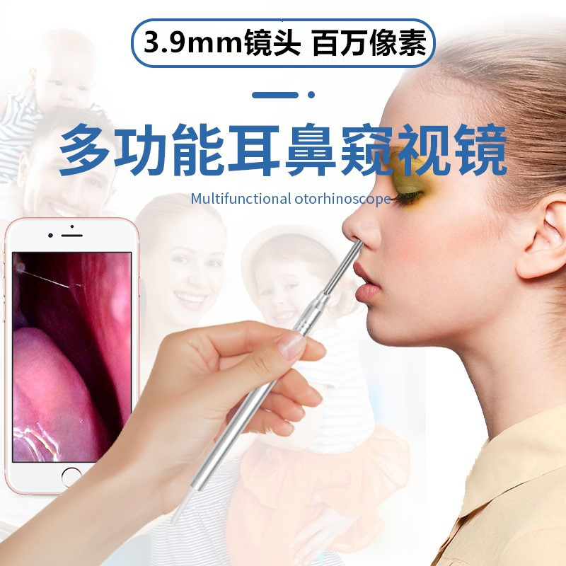 高清可视耳道检查鼻腔窥视镜鼻内镜耳窥镜电子检耳镜耳内镜看耳朵