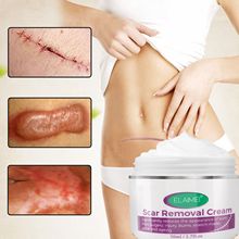 Effective Acne atment ELAIMEI Scar Removal Skin Rebound Scar