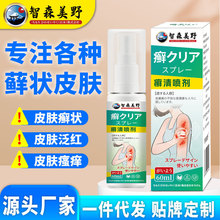 智森美野皮癣牛癣体痒癣脱皮银白斑屑止痒瘙痒草本喷剂