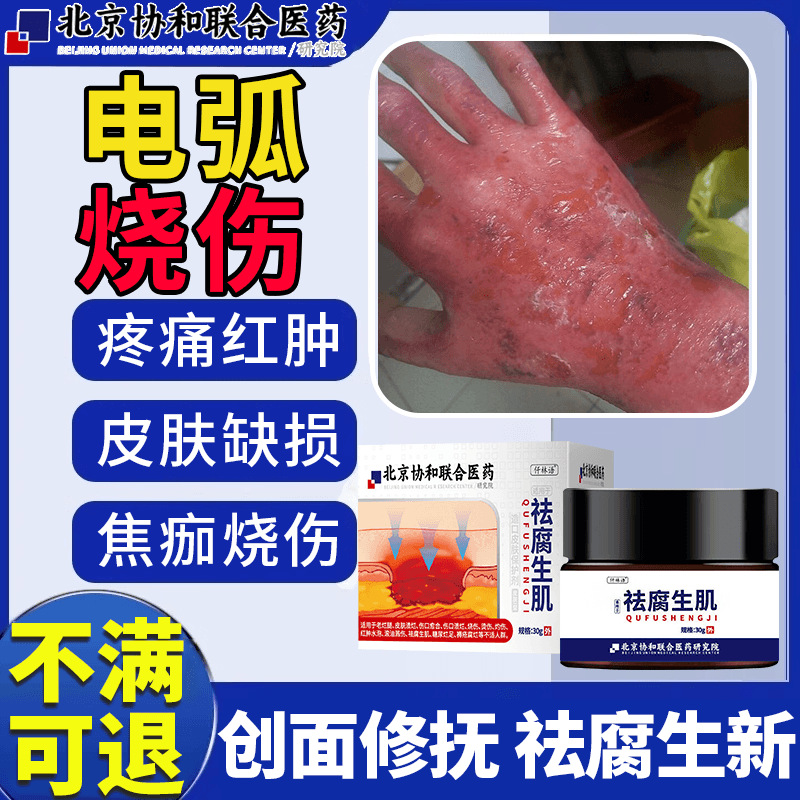 电弧烧伤烫伤膏正品触电击灼伤去皮肤疤痕色素沉淀生长因子敷料gk