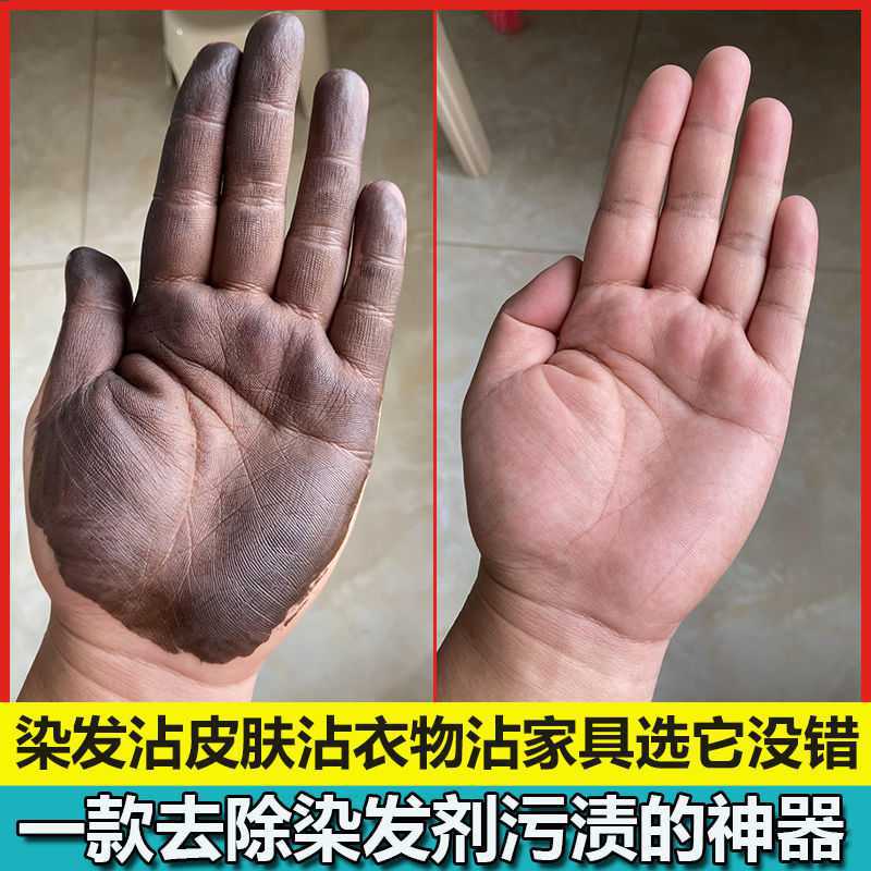 一擦净去除皮肤上染发剂污迹一抹净清洗剂去染发膏残留色清理染色
