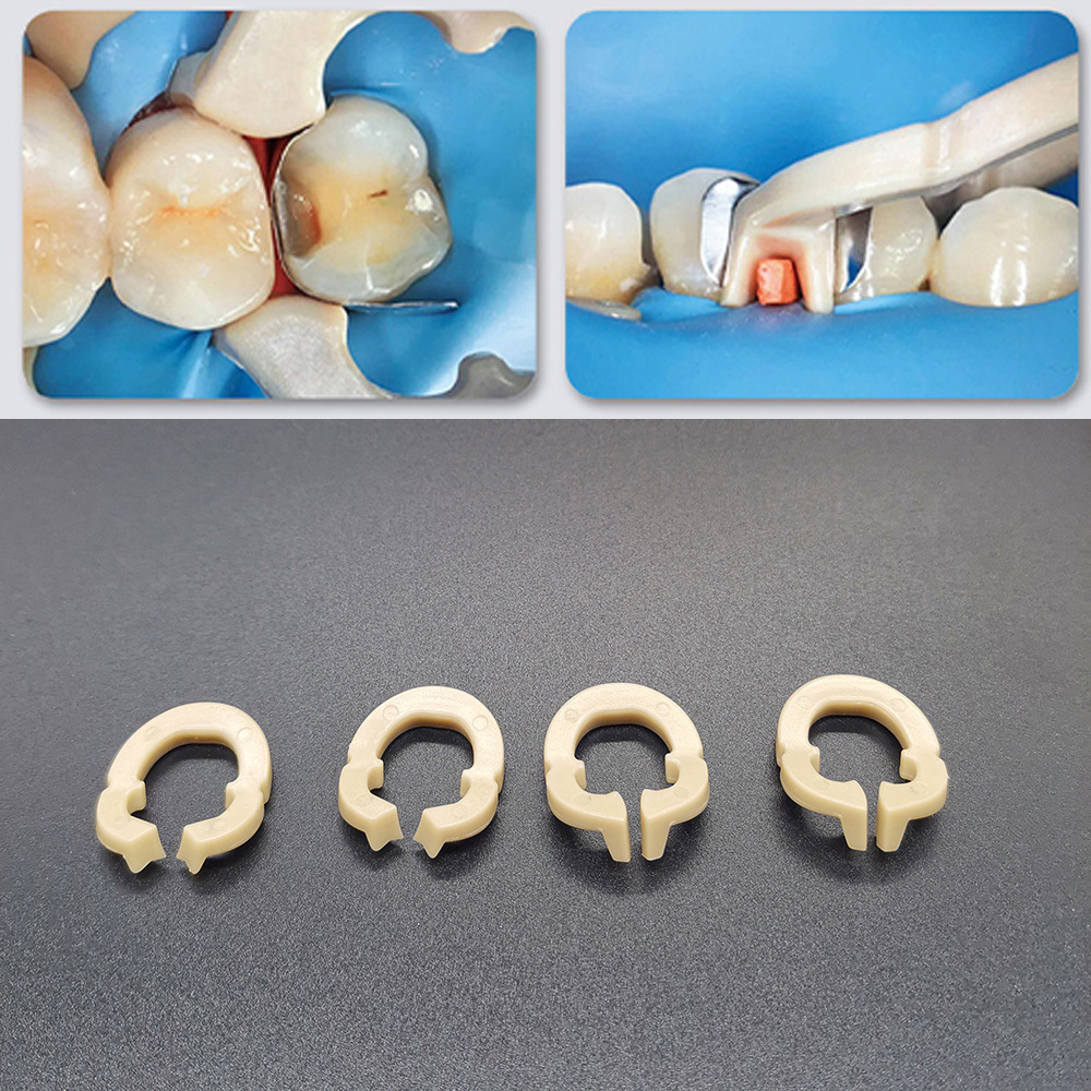 牙科材料 橡皮障夹树脂夹 夹子 乳牙树脂夹 豆瓣成型片树脂夹持环