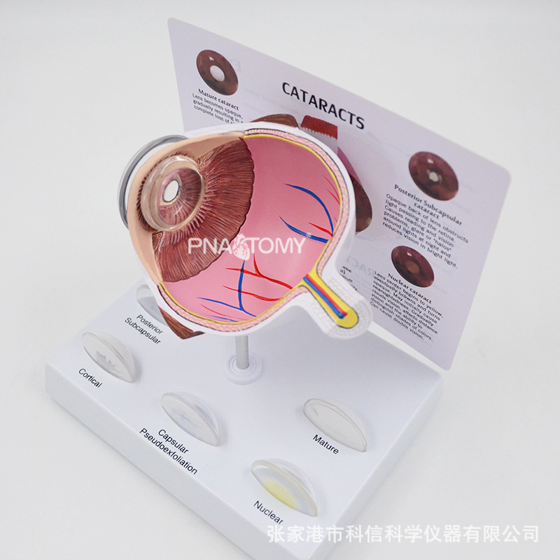眼球模型病理眼球演示教具眼科展示礼品人体器官解剖模型放大教学
