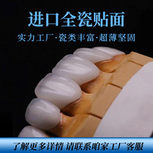牙齿贴片美牙同康美牙全瓷贴片水晶瓷铸瓷冰瓷蓝瓷贴技术培训学习