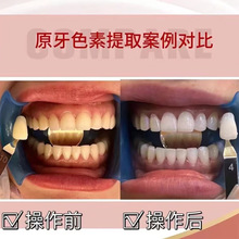 美牙原牙色素提取 原牙色素提取 过氧化氢 牙齿植物护理 美白凝胶