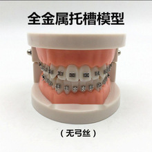 牙齿模型牙科正畸带托假牙模型 医患沟通教学模型 矫正练习托其他