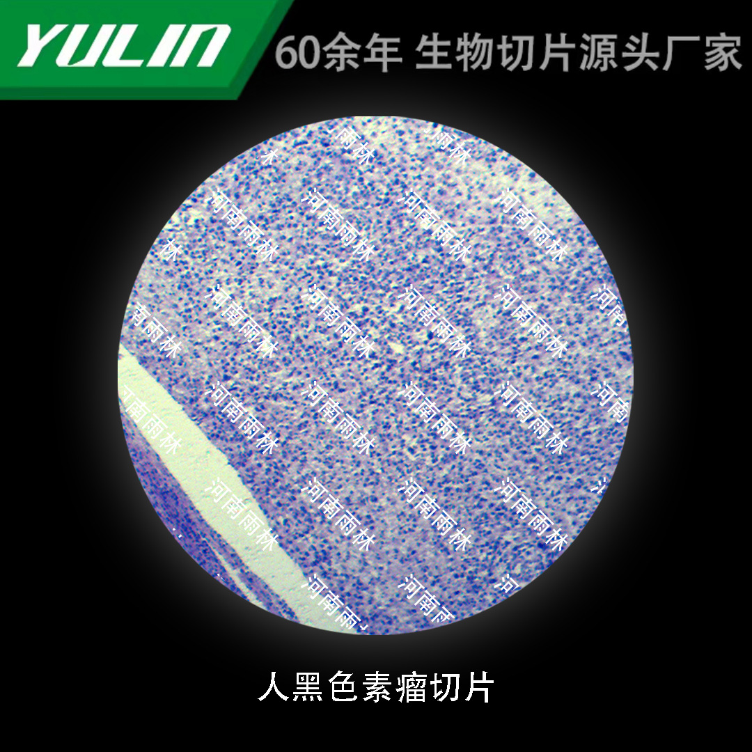 人黑色素瘤切片生物显微镜标本动物植物细胞载玻片观察实验高校