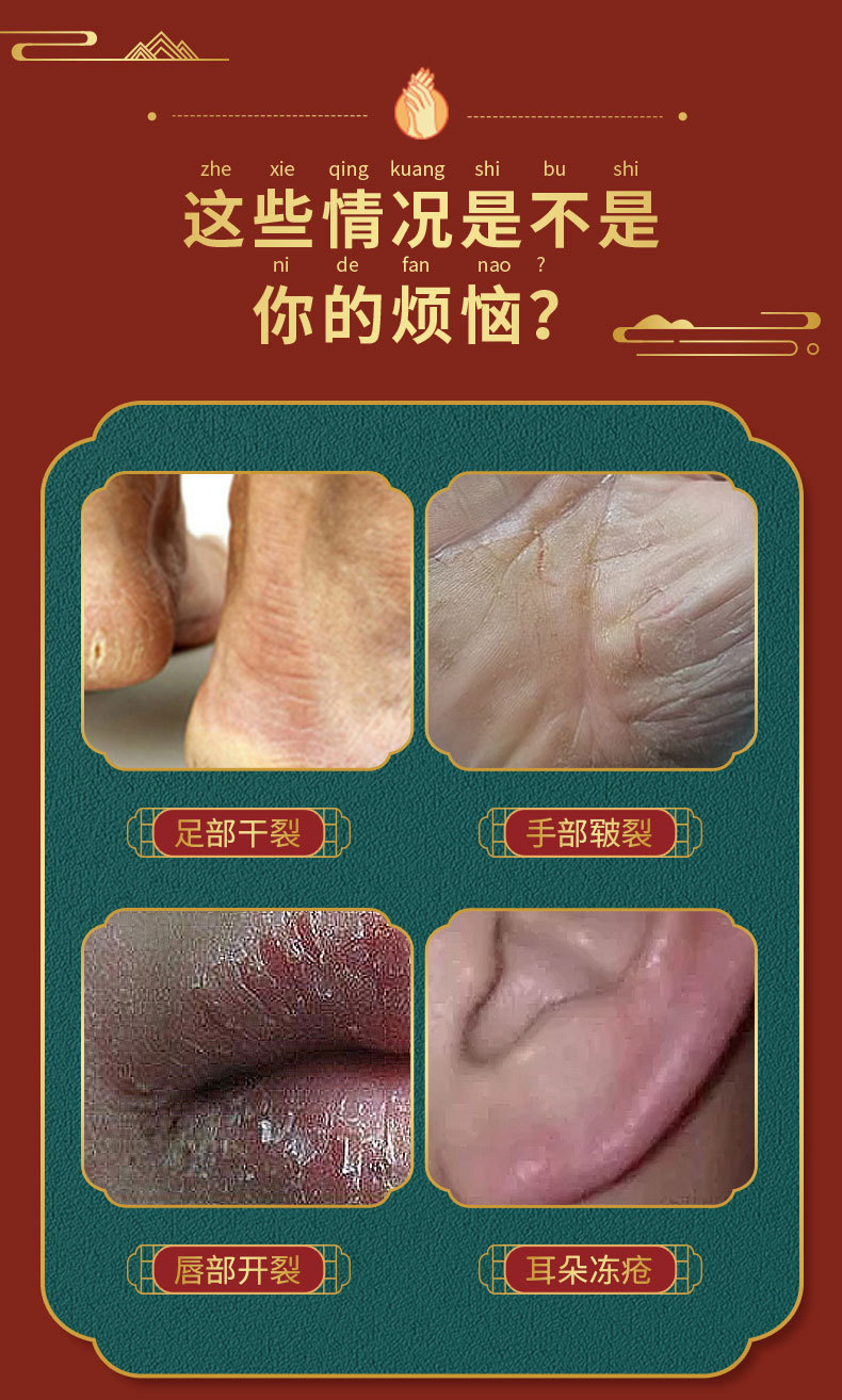 修护货号冻疮专用型护理软膏是否进口否商品条形码6927407587252品牌