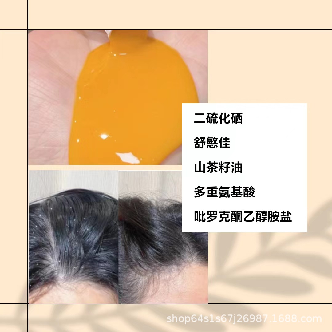 质润二硫化硒洗发水去油蓬松去屑洗发水去油不痒洗发液-阿里巴巴