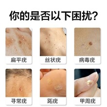去猴子肉粒疙瘩去小肉瘤颈部去除猴子刺猴肉日本跖疣膏足部脖子下