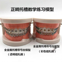 牙齿模型牙科正畸带托假牙模型 医患沟通教学模型 矫正练习托