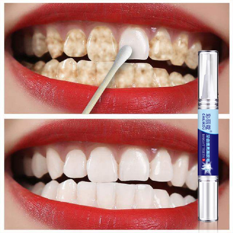 牙齿美白笔牙齿护理祛除黄牙烟牙去茶渍快速的美牙洁牙提亮笔