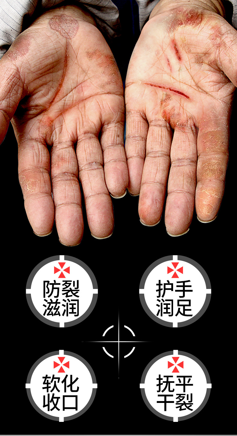 裂可宁护手霜防冻防裂滋润保湿补水足脚后跟干裂膏修复霜男女正品