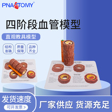 血管模型人体四阶段血管标本心内科医患沟通演示血管硬化模型