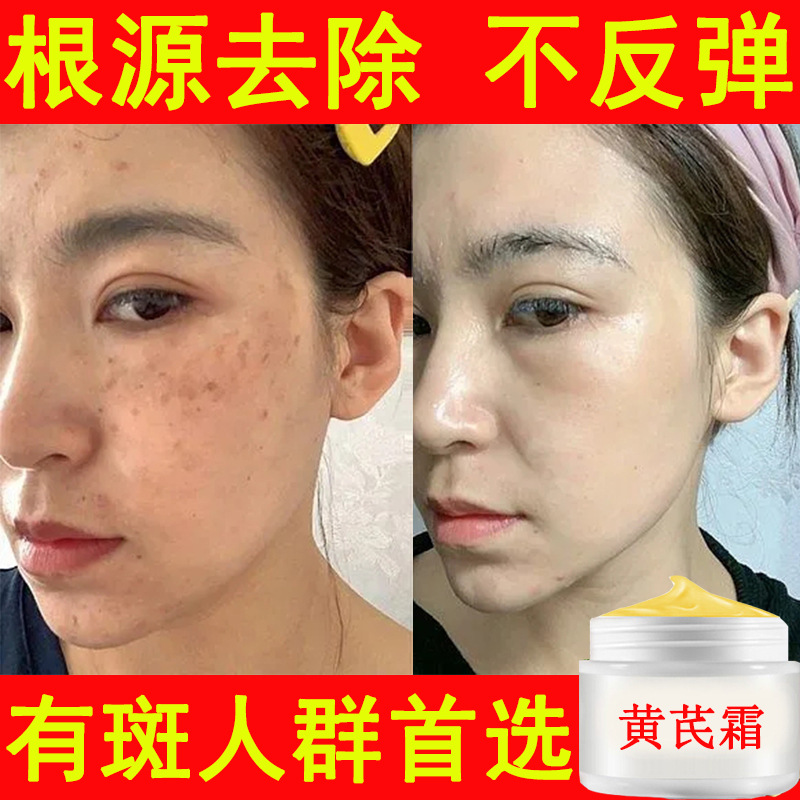 黄芪霜美白去斑霜淡化色斑黄褐斑滋润嫩肤美容院线美白祛斑霜正品