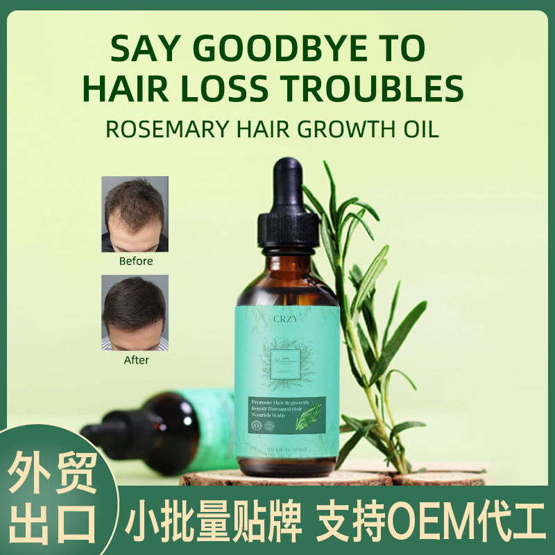 Foreign Trade Cross-Border Thermal Mining Hair Growth Oil Hair Care Essential Oil English Rosemary Nursing Hair Essential Oil