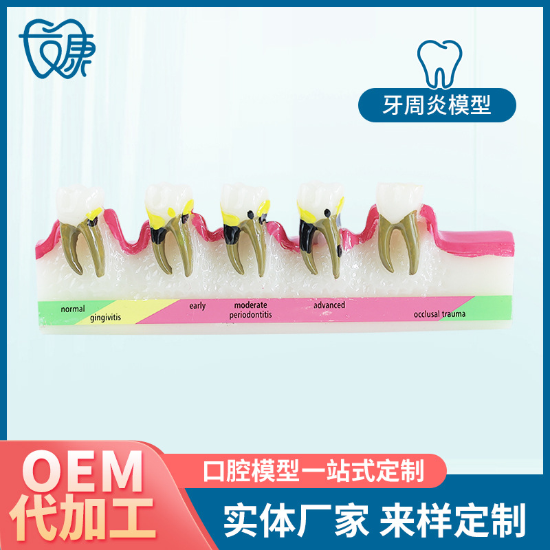 牙周炎模型树脂成人牙周演变牙齿模型口腔牙科展示教学摆件厂家