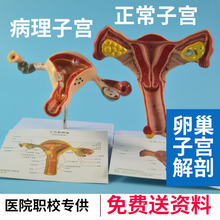 生殖卵巢病理子宫解剖模型 女性正常子宫结构模型 医院职校教具