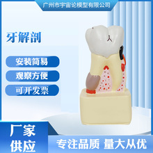 人体牙解剖口腔护理模型 教学口腔科病理医患沟通 牙齿解剖模型