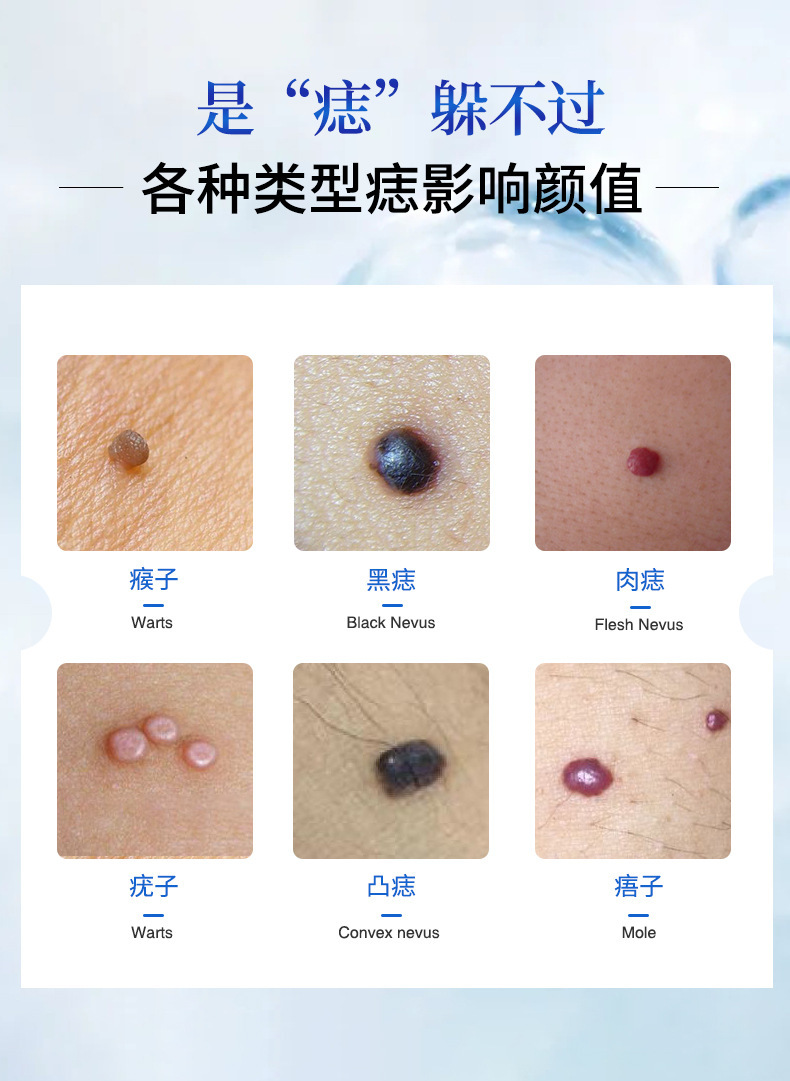 南方协和点痣膏药水脸部点消痣修复液一件代发优肤平消痣套装现货