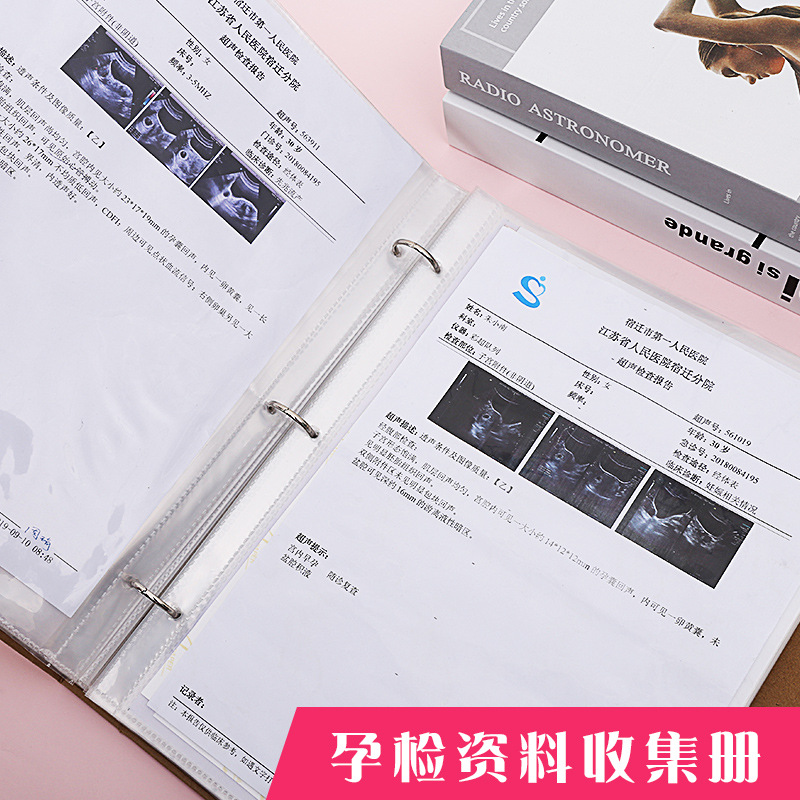 产检怀孕记录册孕妇孕期资料收纳册检查报告记录本b超单收集相册
