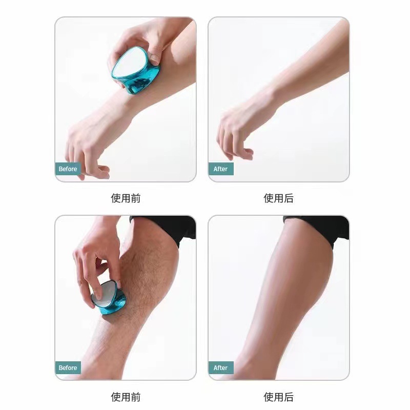 Double-Sided Nano Glass Sanding Device Foot Grinder Double-Effect Dual-Purpose Hair Removal and Skin Grinding Feet Calluses Dead Skin Heel