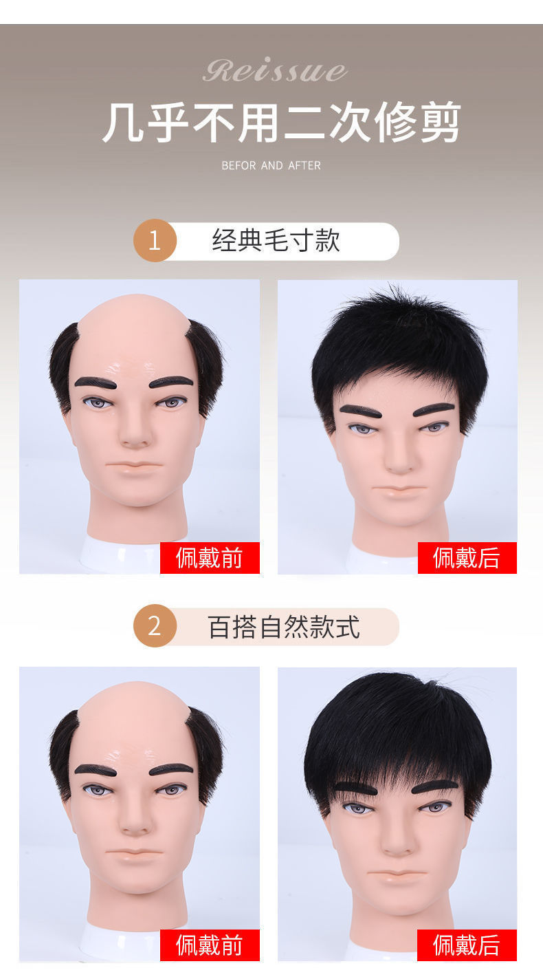 假发男短发头顶补发块秃顶地中海假发片贴男士毛寸全真发韩版帅气