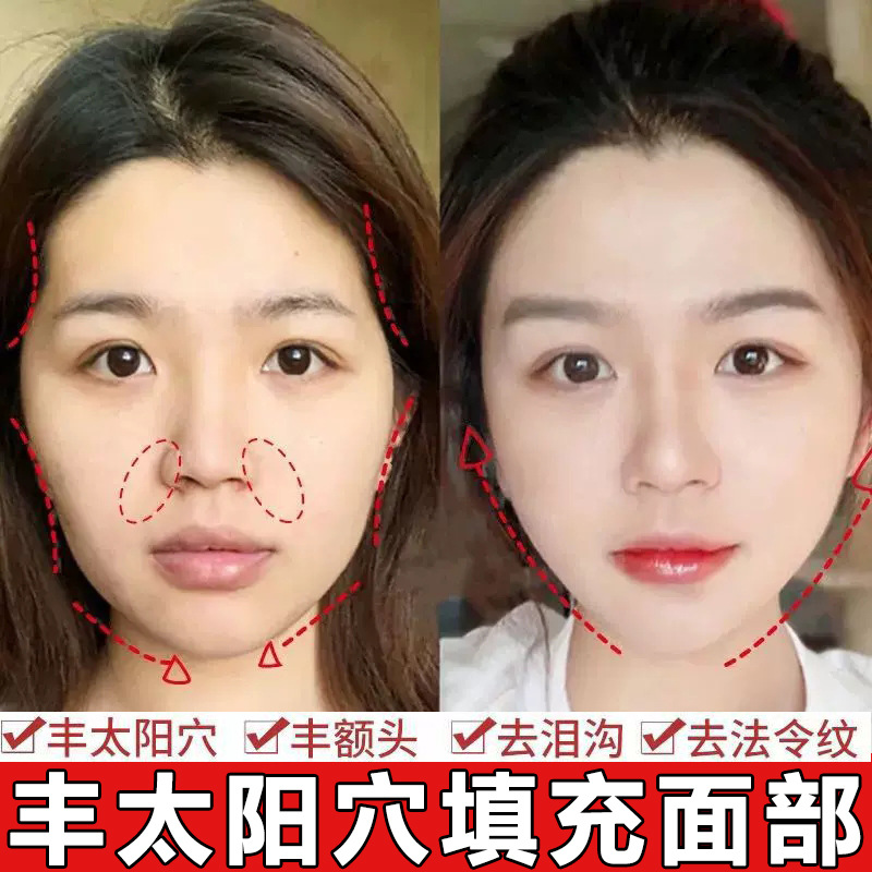 面部丰盈液丰太阳穴重组胶原蛋白饱满面部凹陷填充泪沟丰脸精华液