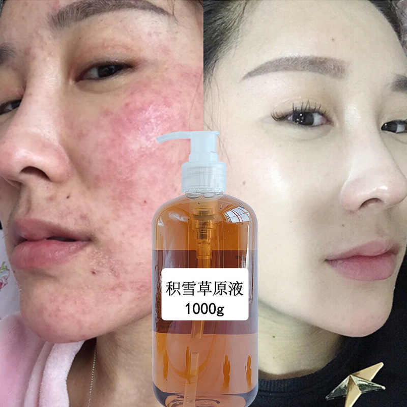 积雪草修复精华液伉敏感肌去红血丝激素脸增厚角质层神经酰胺原液