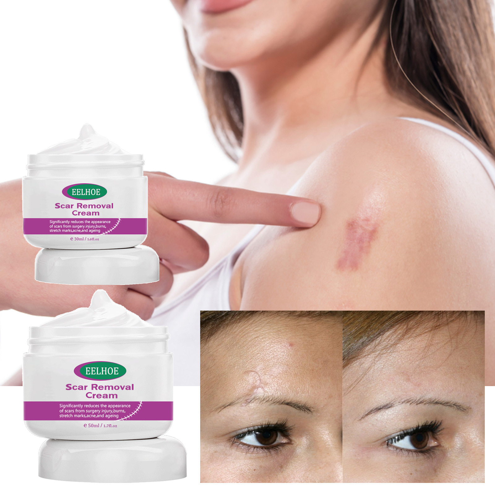 eelhoe淡化伤疤修护霜淡化修护皮肤烫痕烧痕手术疤平滑肌肤护理膏